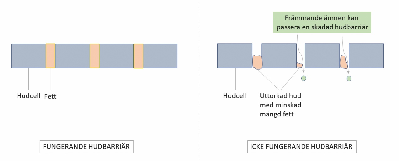 Hudbarriär